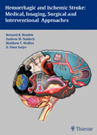 Hemorrhagic & Ischemic Stroke- Medical, Imaging, Surgical & InterventilnalApproaches(With Plus E-Content Online)