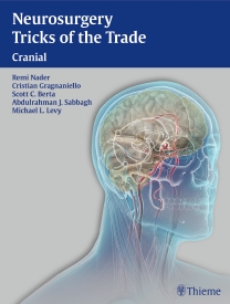 Neurosurgery Tricks of the Trade- Cranial