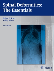 Spinal Deformities, 2nd ed.- The Essentials