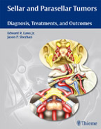 Sellar & Parasellar Tumors- Diagnosis, Treatments & Outcomes