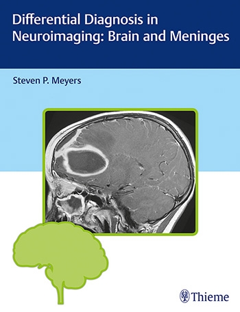Differential Diagnosis in Neuroimaging:Brain & Meninges