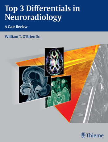 Top 3 Differentials in Neuroradiology- A Case Review
