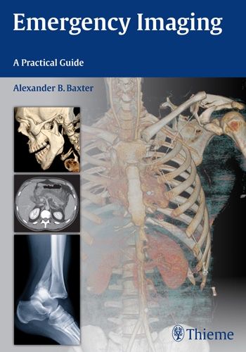 Emergency Imaging- A Practical Guide