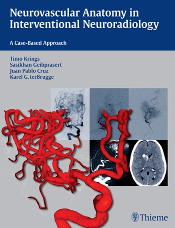 Neurovascular Anatomy in Interventional Neuroradiology- A Case-Based Approach