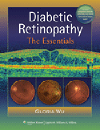 Diabetic Retinopathy- Essentials