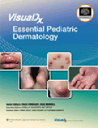 VisualDx: Essential Pediatric Dermatology