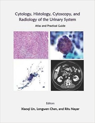 Cytology, Histology, Cystoscopy, & Radiology of UrinarySystem- Atlas & Practical Guide
