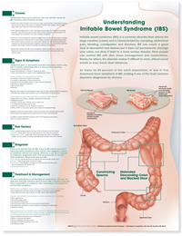 Understanding Irritable Bowel Syndrome Anatomical Chart- Paper Unmounted