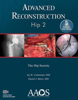 Advanced Reconstruction: Hip, 2nd ed.