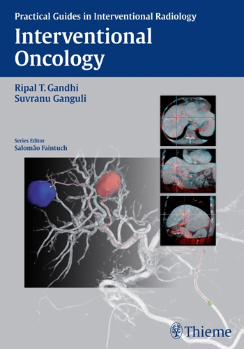Interventional Oncology- Practical Guides in Interventional Radiology