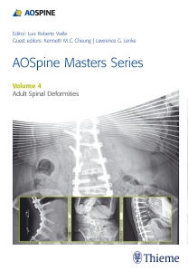 AO Spine Masters SeriesVol.4: Adult Spinal Deformities