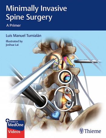 Minimally Invasive Spine SurgeryA Primer