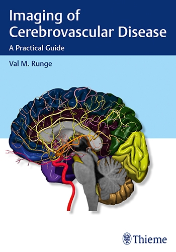 Imaging of Cerebrovascular Disease- A Practical Guide