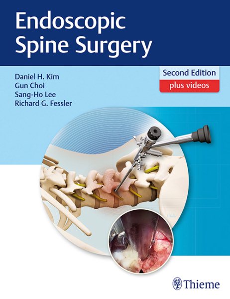 Endoscopic Spine Surgery, 2nd ed.