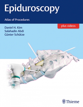 Epiduroscopy- Atlas of Procedures
