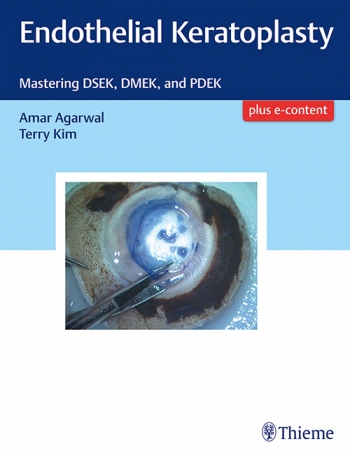 Endothelial Keratoplasty- Mastering Dsek, Dmek & Pdek