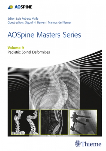 AO Spine Masters SeriesVol.9: Pediatric Spinal Deformities