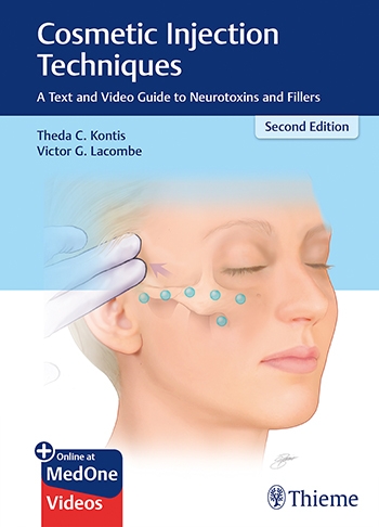 Cosmetic Injection Techniques, 2nd ed.- A Text & Video Guide to Neurotoxins & Fillers