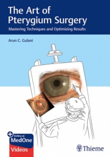 Art of Pterygium Surgery- Mastering Techniques & Optimizing Results