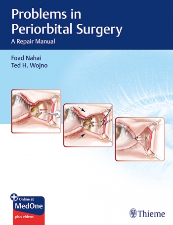 Problems in Periorbital Surgery-A Repair Manual