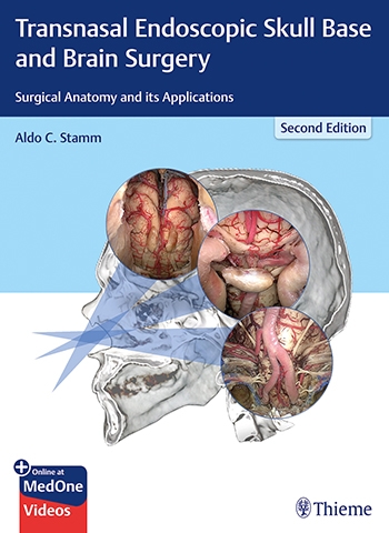 Transnasal Endoscopic Skull Base & Brain Surgery,2nd ed.- Surgical Anatomy & Its Applications