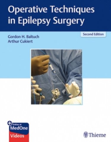 Operative Techniques in Epilepsy Surgery, 2nd ed.