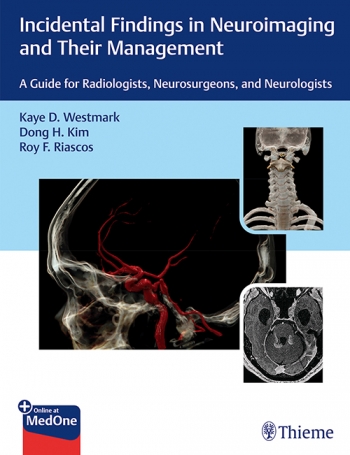 Incidental Findings in Neuroimaging & TheirManagement- Guide for Radiologists, Neurosurgeons, & Neurologist