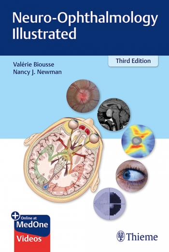 Neuro-Ophthalmology Illustrated, 3rd ed.