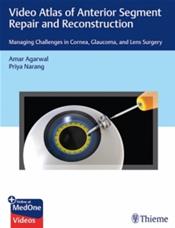 Video Atlas of Anterior Segment Repair & Reconstruction- Managing Challenges in Cornea, Glaucoma &Lens Surgery