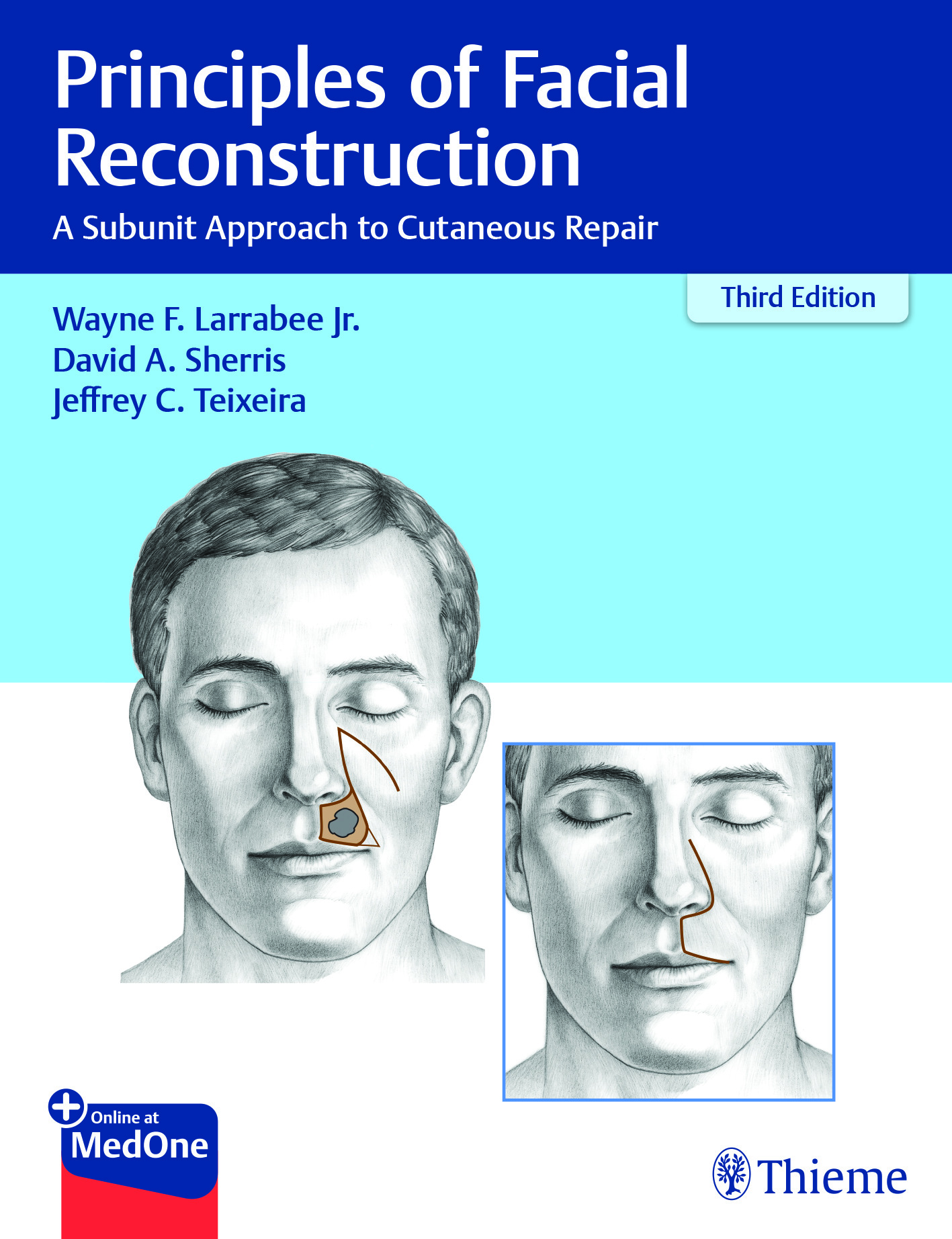 Principles of Facial Reconstruction, 3rd ed.- A Subunit Approach to Cutaneous Repair