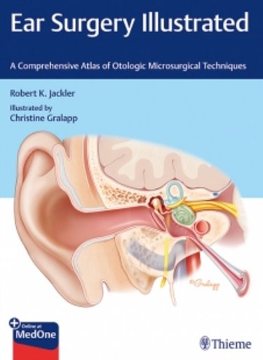 Ear Surgery Illustrated- Comprehensive Atlas of Otologic MicrosurgicalTechniques