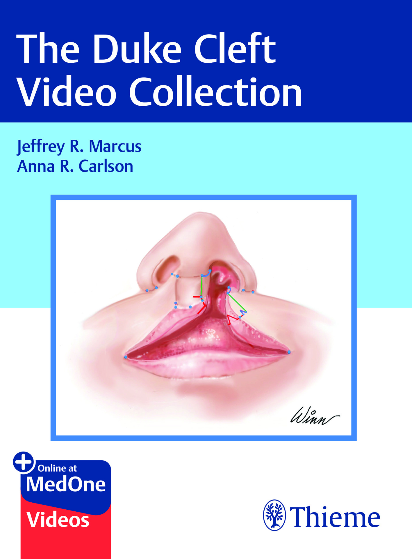 Duke Cleft Video Collection