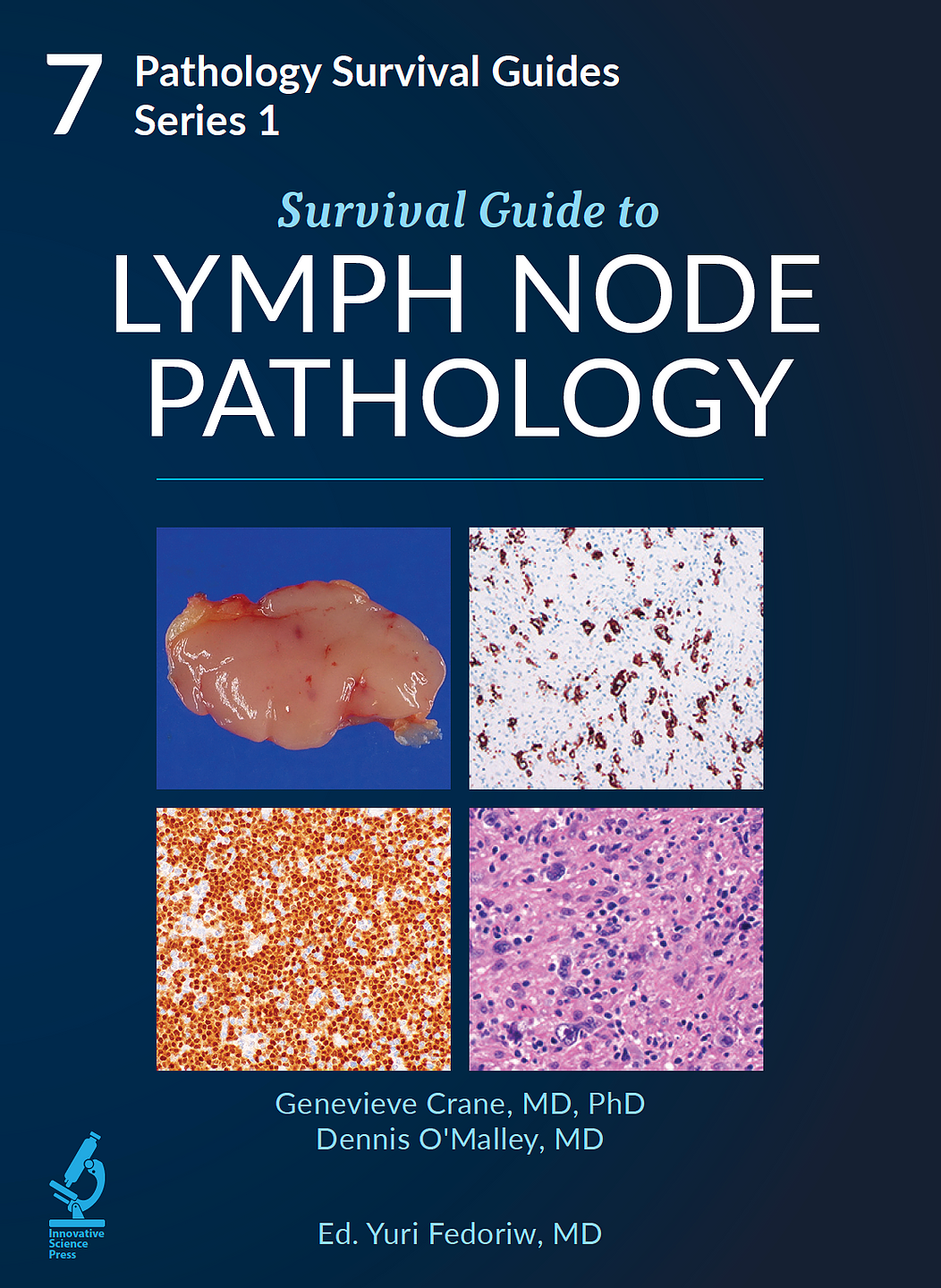 Pathology Survival Guides, Series 1Vol.7: Survival Guide to Lymph Node Pathology