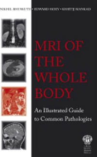 MRI of the Whole Body- An Illustrated Guide to Common Pathologies
