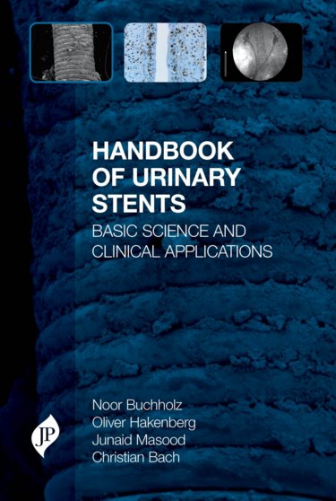 Handbook of Urinary Stents- Basic Science & Clinical Applications