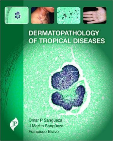 Dermatopathology of Tropical Diseases- Pathology & Clinical Correlations