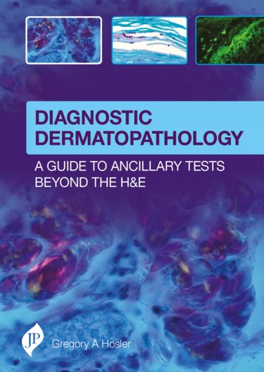 Diagnostic Dermatopathology- A Guide to Ancillary Tests Beyond the H&E