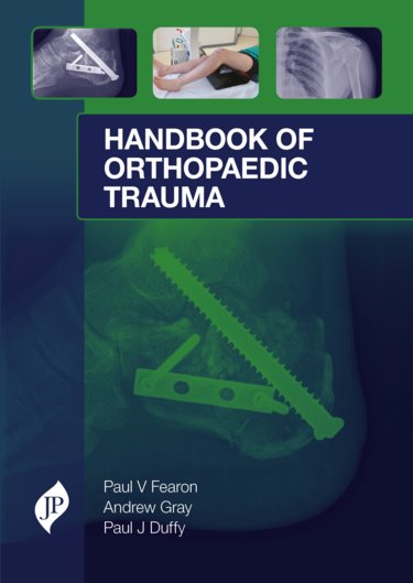 Handbook of Orthopaedic Trauma- Surgical Management from Admission to Rehabilitation