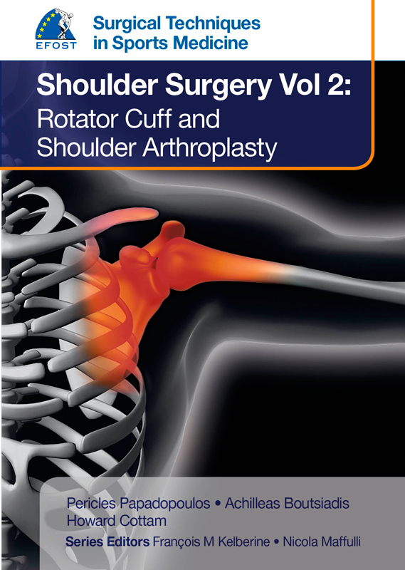 Surgical Techniques in Sports Medicine:Shoulder Surgery, Vol.2:Rotator Cuff & ShoulderArthroplasty