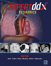 Expert Differential Diagnoses: Pediatrics