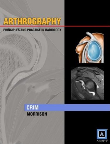 Arthrography- Principles & Practice in Radiology(Specialty Imaging Series)