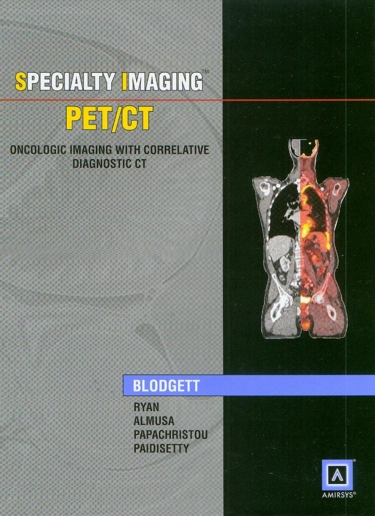 PET/CT-Oncologic Imaging with Correlative Diagnostic CT(Specialty Imaging Series)