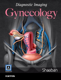 Diagnostic Imaging: Gynecology, 2nd ed.