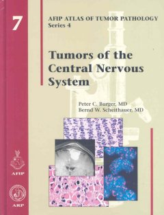 Atlas of Tumor Pathology, 4th Series, Fascicle 7- Tumors of Central Nervous System