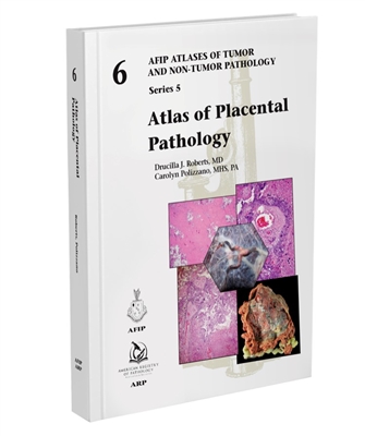 Atlases of Tumor & Non-Tumor Pathology, 5th Series,Fascicle 6- Atlas of Placental Pathology