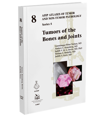 Atlases of Tumor & Non-Tumor Pathology, 5th Series,Fascicle 8- Tumors of the Bones & Joints