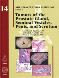 Atlas of Tumor Pathology, 4th Series, Fascicle 14- Tumors of the Prostate Gland, Seminal Vesicles,Penis, & Scrotum