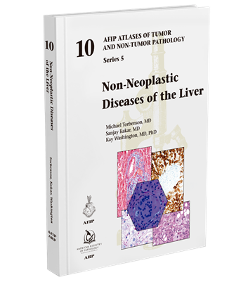 Atlases of Tumor & Non-Tumor Pathology, 5th Series,Fascicle 10- Non-Neoplastic Diseases of Liver