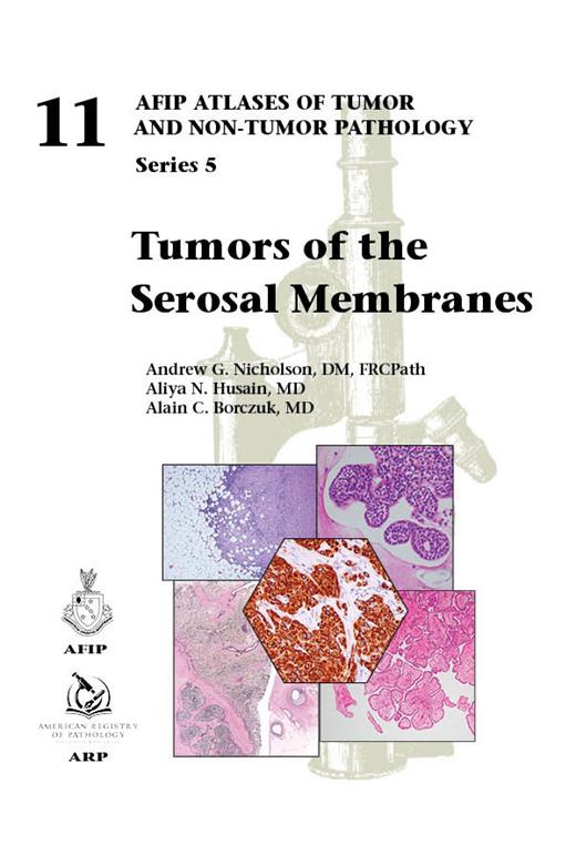 Atlases of Tumor & Non-Tumor Pathology, 5th Series,Fascicle 11- Tumors of Serosal Membranes