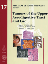 Atlas of Tumor Pathology, 4th Series, Fascicle 17- Tumors of the Upper Aerodigestive Tract & Ear